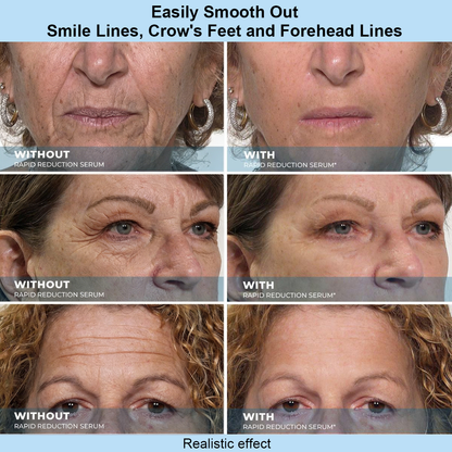 Beurevialuxe™ Rapid Smoothing Serum | A Firmer, Fresher Look in Just 60 Seconds