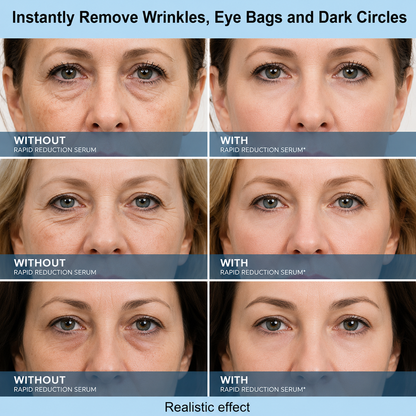 Seevenlly™ Instant Face Tightener – Visible Lift in 30 Seconds